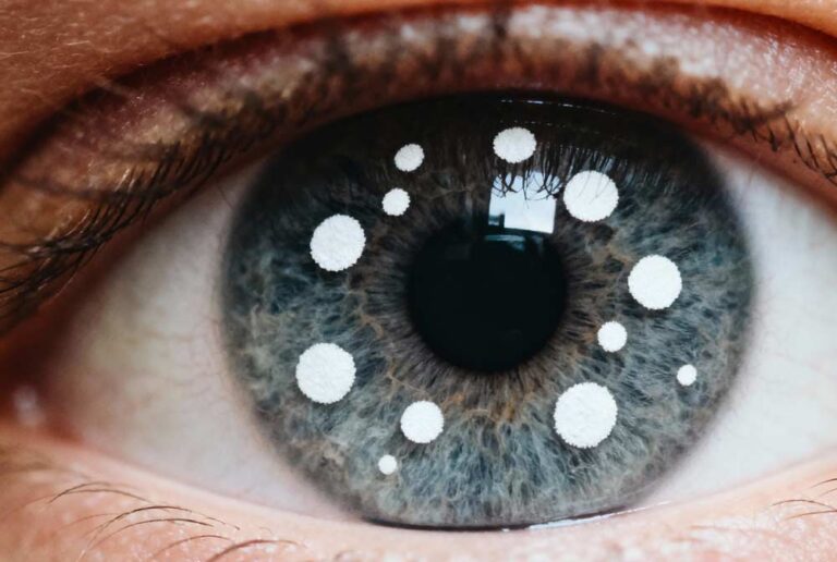 Manchas en los ojos en la parte blanca: causas, síntomas y tratamientos esenciales